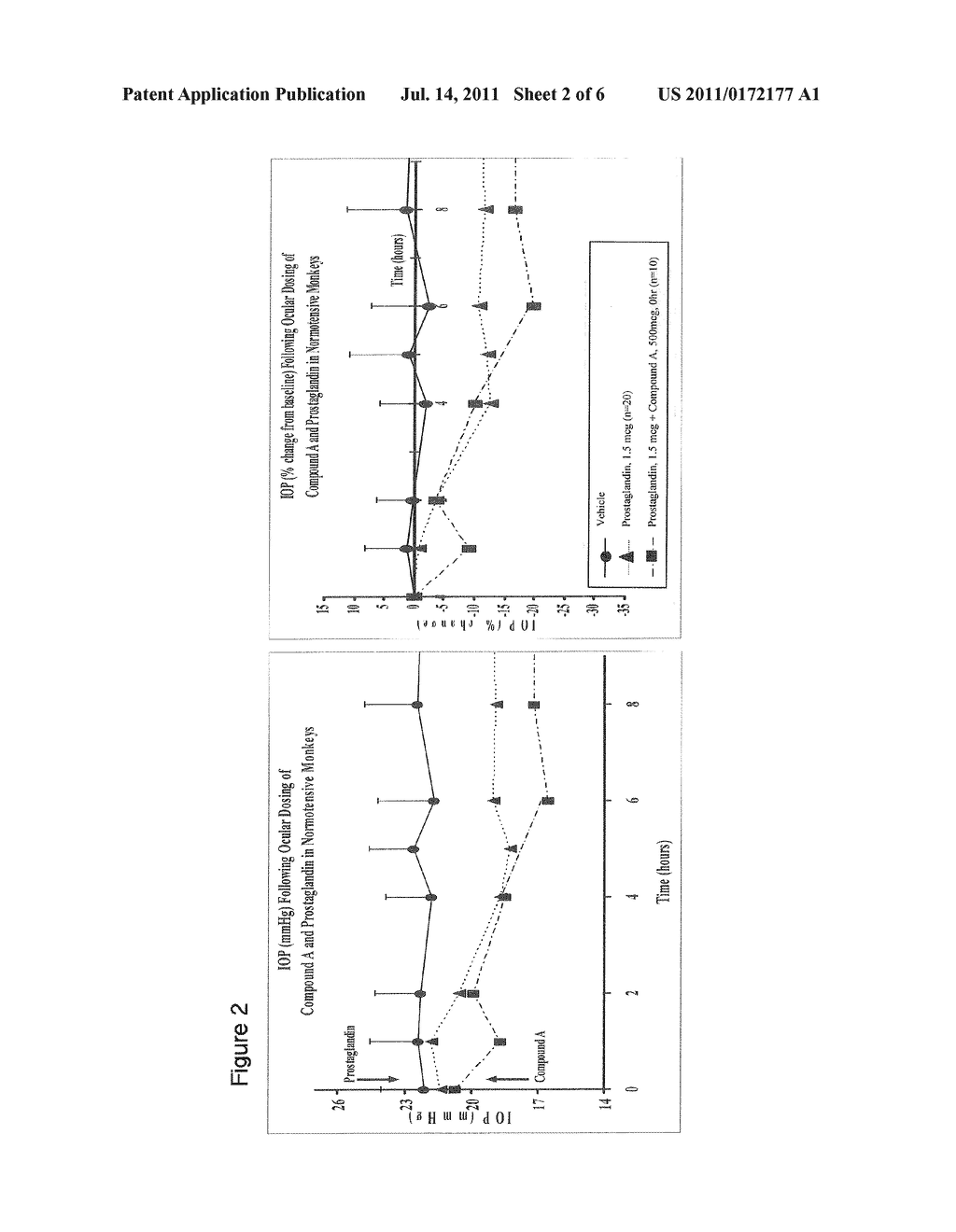 COMBINATION, KIT AND METHOD OF REDUCING INTRAOCULAR PRESSURE - diagram, schematic, and image 03