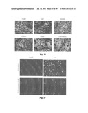 USE OF TARGETED NITROXIDE AGENTS IN PREVENTING, MITIGATING AND TREATING     RADIATION INJURY diagram and image