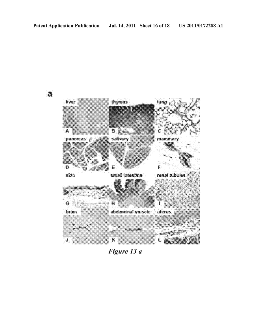 Compositions and Methods for the Identification, Assessment, Prevention     and Therapy of Thymic Lymphoma or Hamartomatous Tumours - diagram, schematic, and image 17