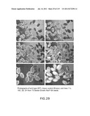 Isoforms of eIF-5A: Senescence-induced eIF5A; Wounding-induced elF-5A;     Growth elF-5A; and DHS diagram and image