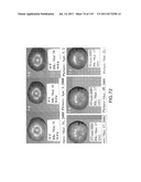 Isoforms of eIF-5A: Senescence-induced eIF5A; Wounding-induced elF-5A;     Growth elF-5A; and DHS diagram and image