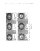 Isoforms of eIF-5A: Senescence-induced eIF5A; Wounding-induced elF-5A;     Growth elF-5A; and DHS diagram and image