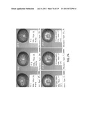 Isoforms of eIF-5A: Senescence-induced eIF5A; Wounding-induced elF-5A;     Growth elF-5A; and DHS diagram and image