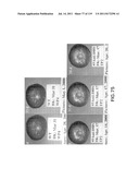 Isoforms of eIF-5A: Senescence-induced eIF5A; Wounding-induced elF-5A;     Growth elF-5A; and DHS diagram and image