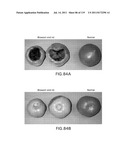 Isoforms of eIF-5A: Senescence-induced eIF5A; Wounding-induced elF-5A;     Growth elF-5A; and DHS diagram and image