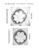 Isoforms of eIF-5A: Senescence-induced eIF5A; Wounding-induced elF-5A;     Growth elF-5A; and DHS diagram and image