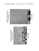 Isoforms of eIF-5A: Senescence-induced eIF5A; Wounding-induced elF-5A;     Growth elF-5A; and DHS diagram and image