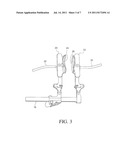 SURGICAL RETRACTOR WITH CURVED ROTATING BLADES diagram and image