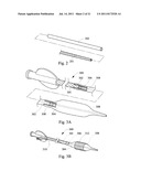 MULTIFILAR CABLE CATHETER diagram and image