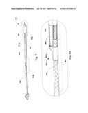 MULTIFILAR CABLE CATHETER diagram and image