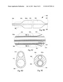 MULTIFILAR CABLE CATHETER diagram and image