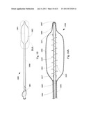 MULTIFILAR CABLE CATHETER diagram and image