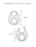 MULTIFILAR CABLE CATHETER diagram and image