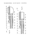 MULTIFILAR CABLE CATHETER diagram and image