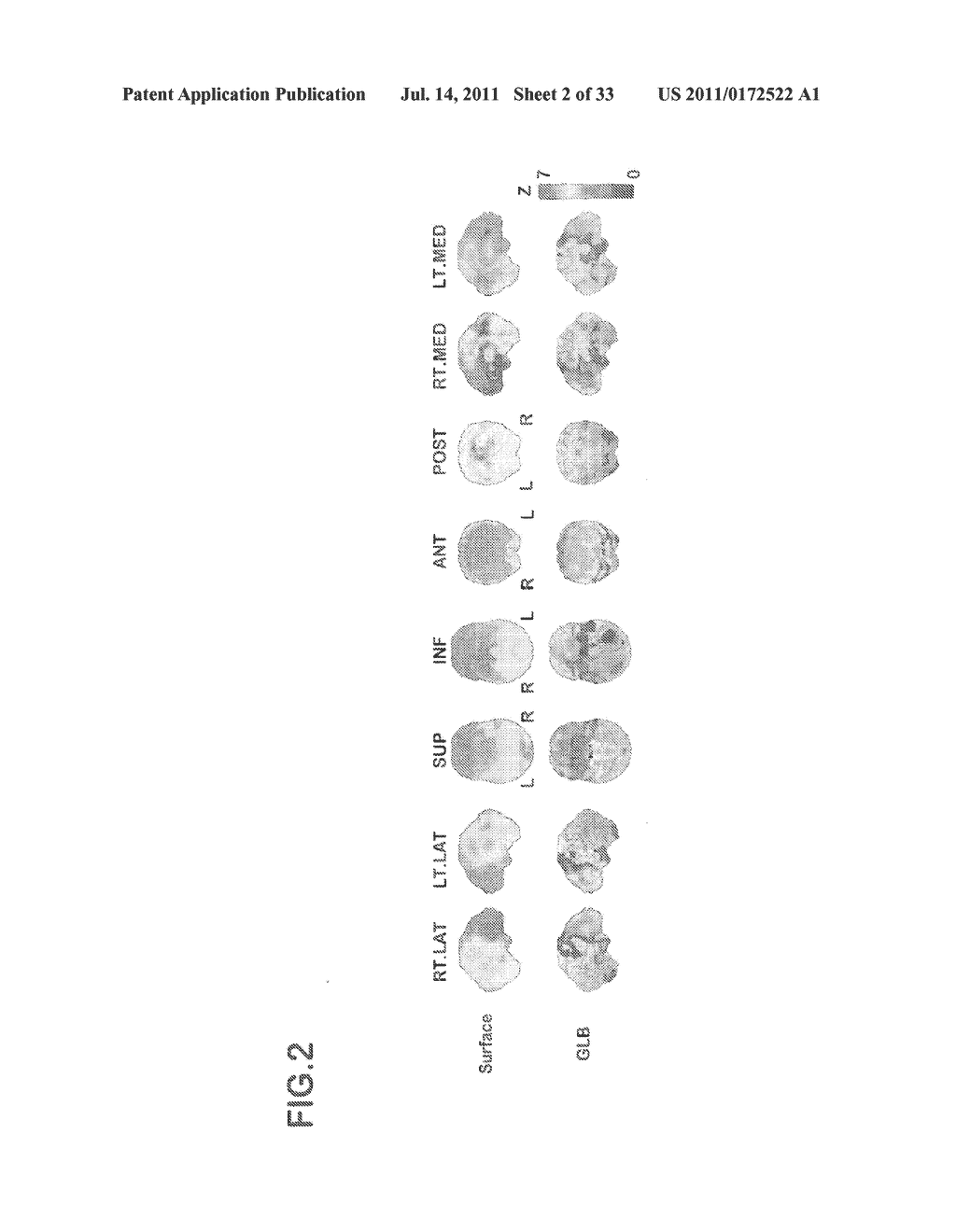 DEVICE FOR CREATING DATABASE OF ALTERNATIVE NORMAL BRAIN - diagram, schematic, and image 03