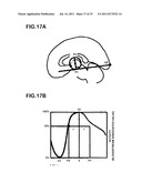 DEVICE FOR CREATING DATABASE OF ALTERNATIVE NORMAL BRAIN diagram and image