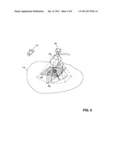 Feature Tracking Using Ultrasound diagram and image