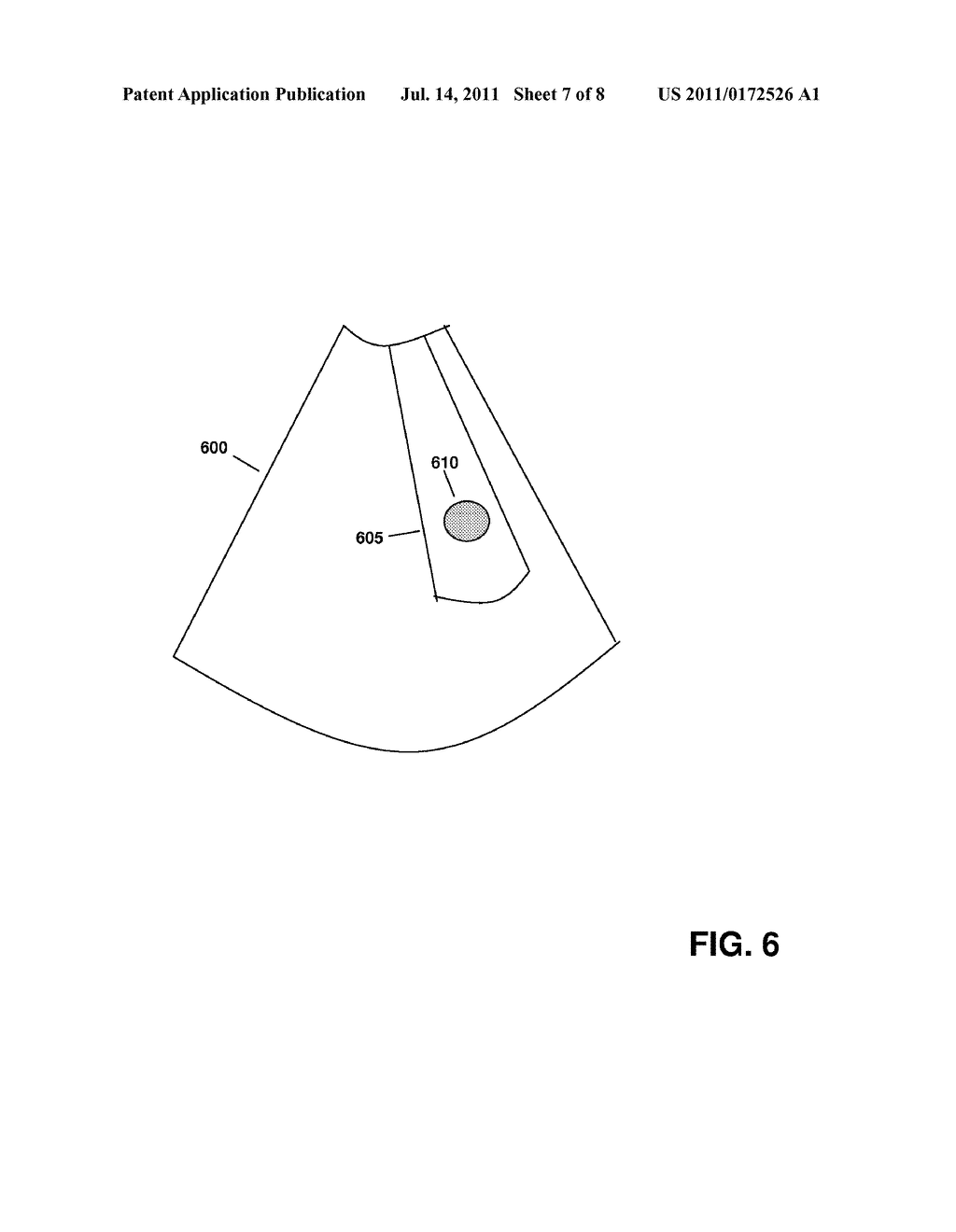 Feature Tracking Using Ultrasound - diagram, schematic, and image 08