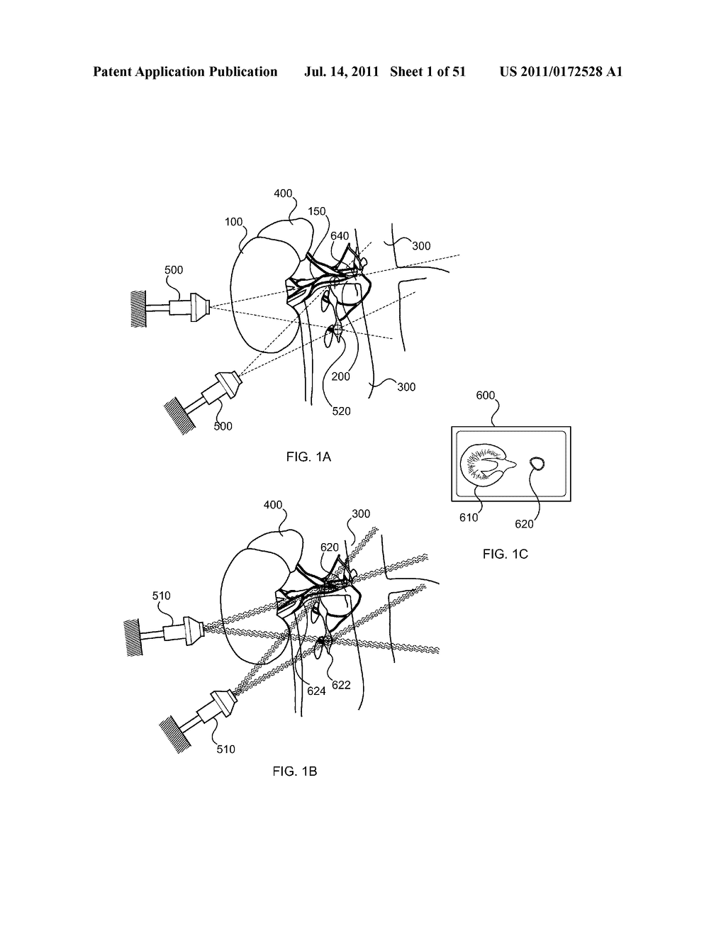 SYSTEMS AND METHODS FOR TREATMENT USING ULTRASONIC ENERGY - diagram, schematic, and image 02