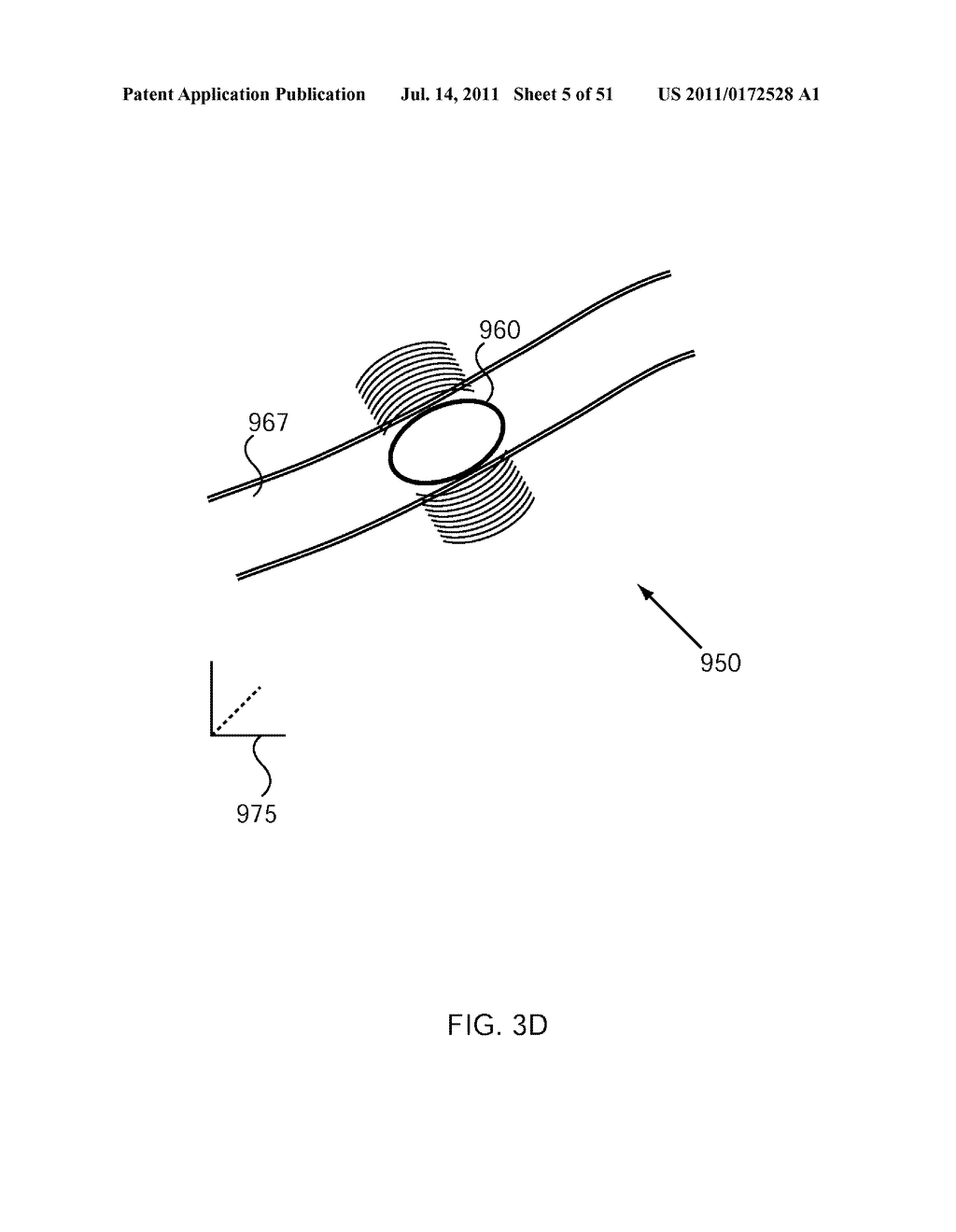 SYSTEMS AND METHODS FOR TREATMENT USING ULTRASONIC ENERGY - diagram, schematic, and image 06