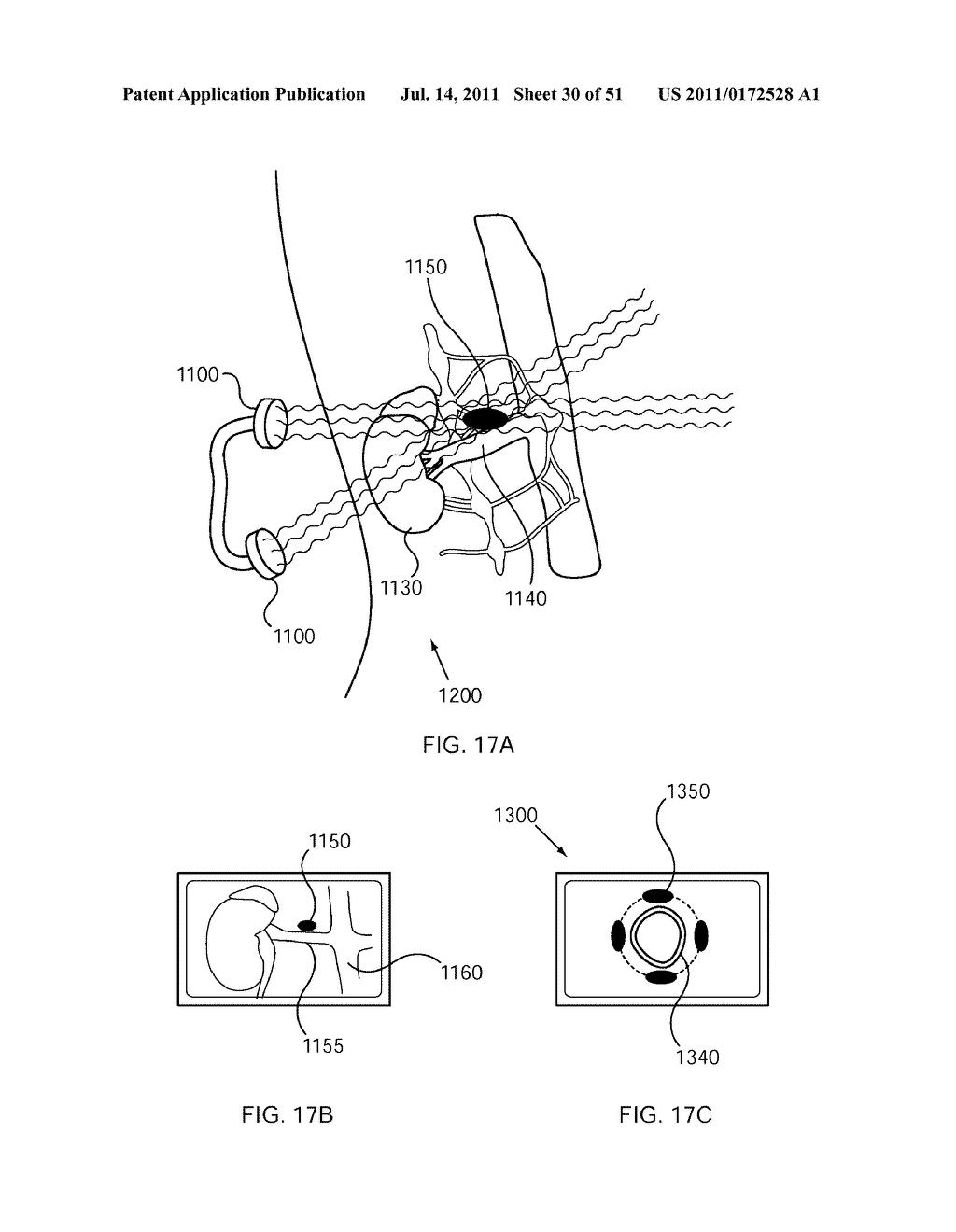 SYSTEMS AND METHODS FOR TREATMENT USING ULTRASONIC ENERGY - diagram, schematic, and image 31