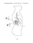 FLOW DIRECTED HEATING OF NERVOUS STRUCTURES diagram and image