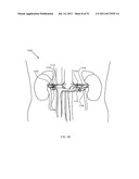 FLOW DIRECTED HEATING OF NERVOUS STRUCTURES diagram and image