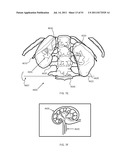 FLOW DIRECTED HEATING OF NERVOUS STRUCTURES diagram and image