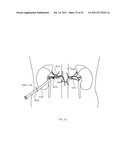 FLOW DIRECTED HEATING OF NERVOUS STRUCTURES diagram and image