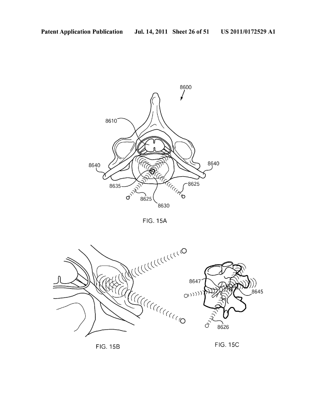 FLOW DIRECTED HEATING OF NERVOUS STRUCTURES - diagram, schematic, and image 27