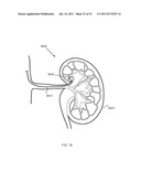 FLOW DIRECTED HEATING OF NERVOUS STRUCTURES diagram and image