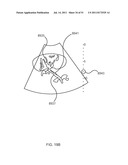 FLOW DIRECTED HEATING OF NERVOUS STRUCTURES diagram and image