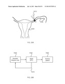 FLOW DIRECTED HEATING OF NERVOUS STRUCTURES diagram and image