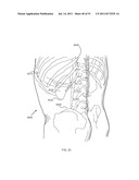 FLOW DIRECTED HEATING OF NERVOUS STRUCTURES diagram and image