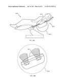 FLOW DIRECTED HEATING OF NERVOUS STRUCTURES diagram and image