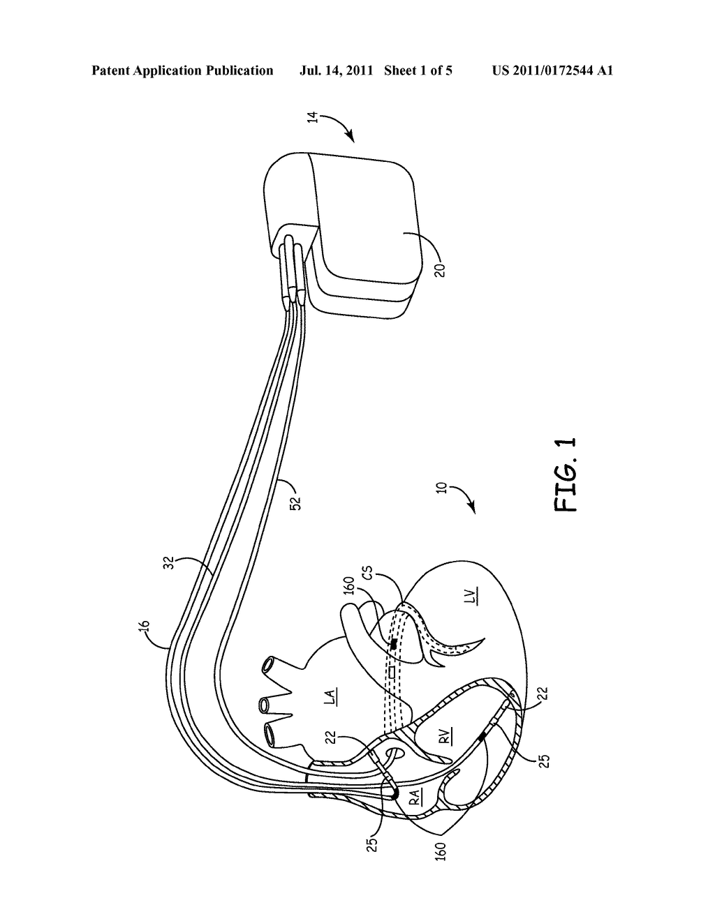 METHOD FOR CONTINUOUS BAROREFLEX SENSITIVITY MEASUREMENT - diagram, schematic, and image 02