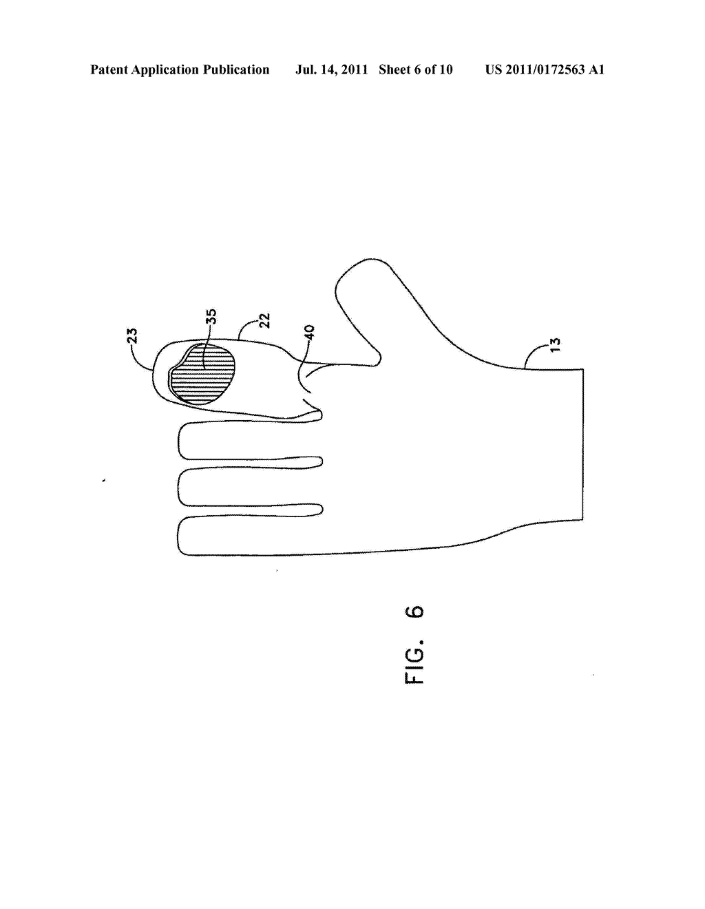 Apparatus and Method for Measuring the Dimensions of the Palpable Surface     of the Prostate - diagram, schematic, and image 07