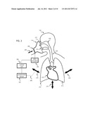 METHOD AND APPARATUS FOR IMPROVED CARDIO-PULMONARY RESUSCITATION diagram and image