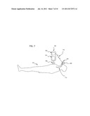 METHOD AND APPARATUS FOR IMPROVED CARDIO-PULMONARY RESUSCITATION diagram and image