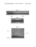 SYSTEMS AND METHODS FOR BARIATRIC THERAPY diagram and image