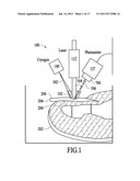 Treatment of Microbial Infections Using Hot and Cold Thermal Shock and     Pressure diagram and image