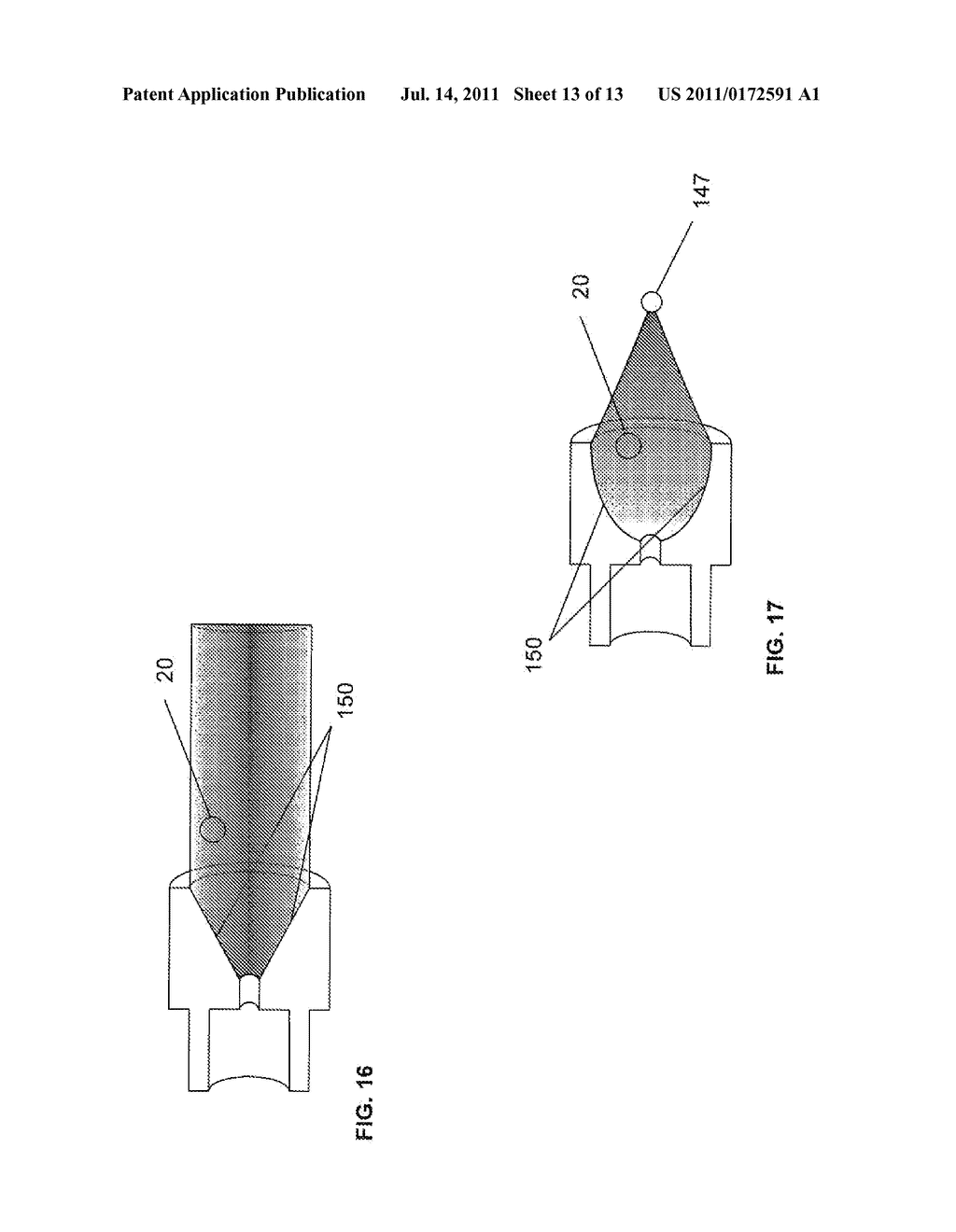 PORTABLE TOPICAL HYPERBARIC SKIN THERAPY AND WOUND TREATMENT SYSTEM - diagram, schematic, and image 14