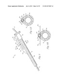 Temporary Retention Device diagram and image