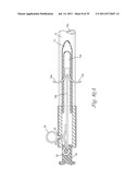 Temporary Retention Device diagram and image