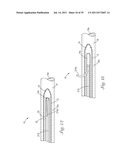 Temporary Retention Device diagram and image