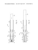 Temporary Retention Device diagram and image