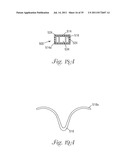 Temporary Retention Device diagram and image