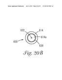 Temporary Retention Device diagram and image