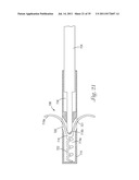 Temporary Retention Device diagram and image