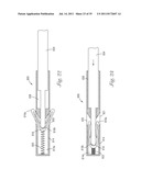 Temporary Retention Device diagram and image